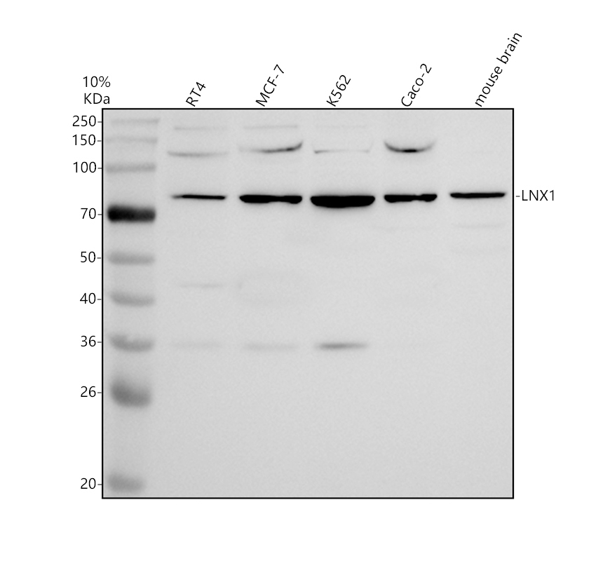 Western blot analysis of LNX1 using anti-LNX1 antibody (A06813-2)