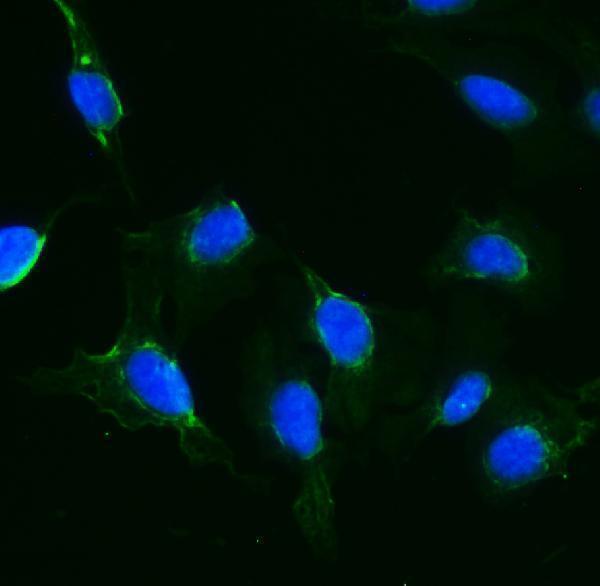 a06814 1 ift88 primary antibodies if testing 5