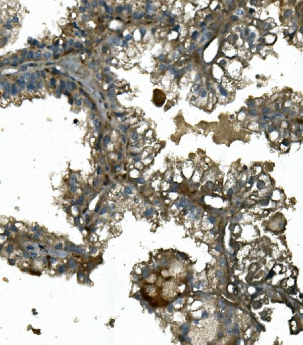  IHC analysis of IFT88 using anti-IFT88 antibody (A06814-1)