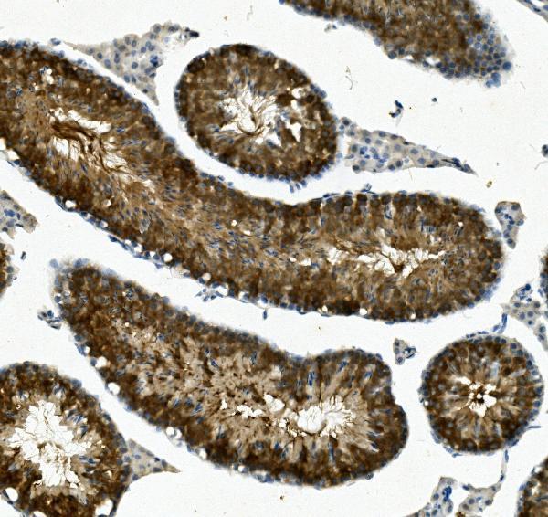  IHC analysis of IFT88 using anti-IFT88 antibody (A06814-1)