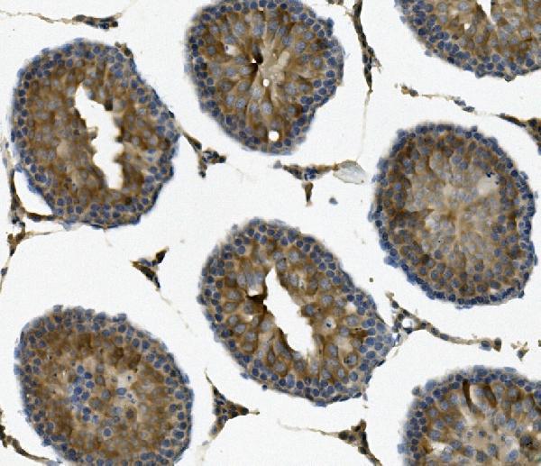 a06814 1 ift88 primary antibodies ihc testing 4