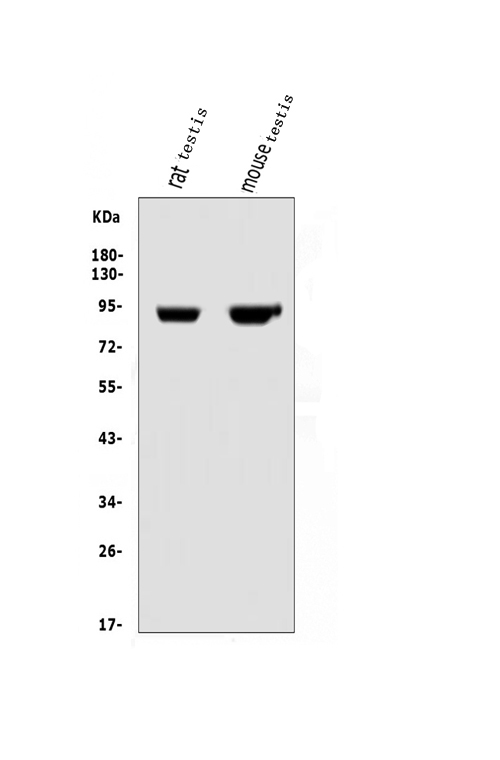  Western blot analysis of IFT88 using anti-IFT88 antibody (A06814-1)