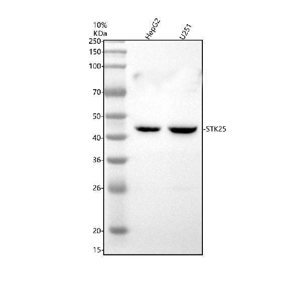 Western blot analysis of STK25 using anti-STK25 antibody (A06816-1)