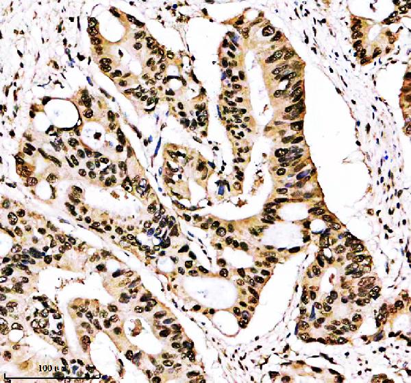 IHC analysis of Histone H3