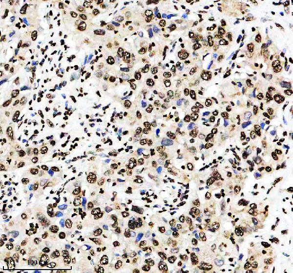 IHC analysis of Histone H3