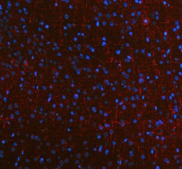 a06821 2 nefm primary antibodies if testing 1