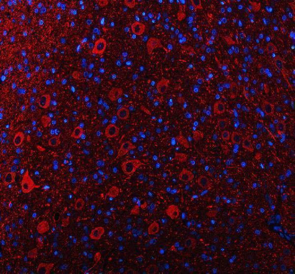 a06821 2 nefm primary antibodies if testing 2