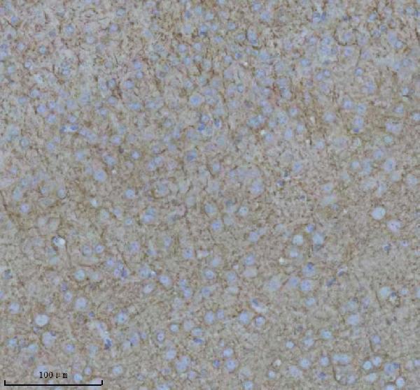 a06821 2 nefm primary antibodies ihc testing 2