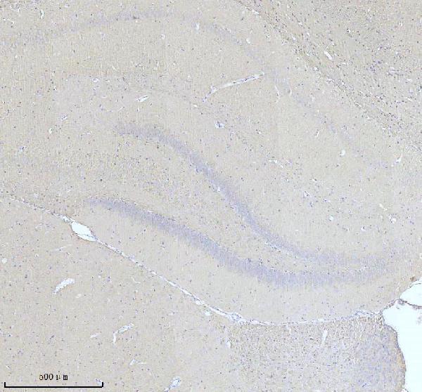 a06821 2 nefm primary antibodies ihc testing 3