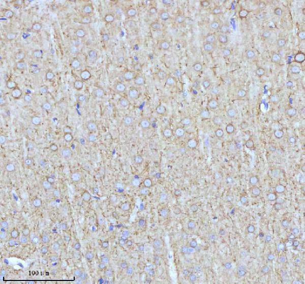 a06821 2 nefm primary antibodies ihc testing 4