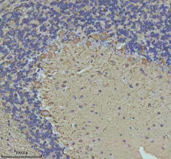 IHC analysis of NF-M/NEFM using anti-NF-M/NEFM antibody (A06821-2)