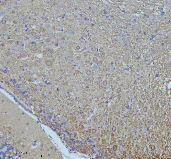 IHC analysis of NF-M/NEFM using anti-NF-M/NEFM antibody (A06821-2)