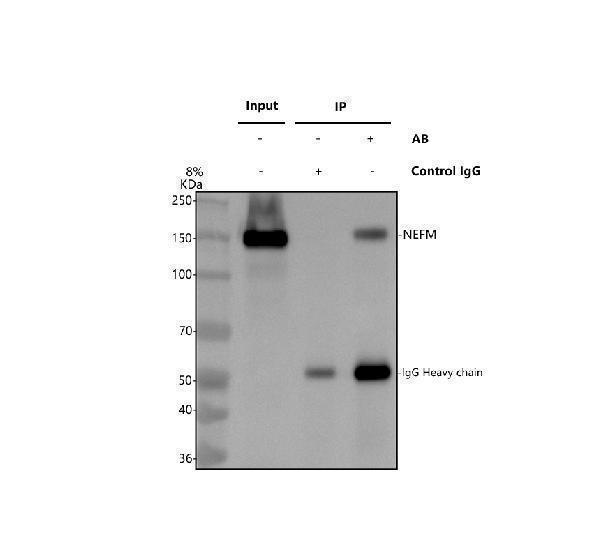 a06821 2 nefm primary antibodies ip testing 1