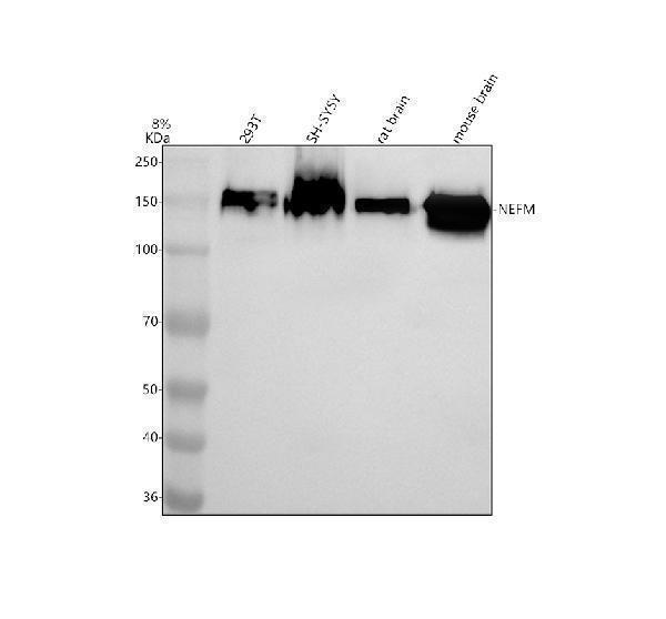 Western blot analysis of NF-M/NEFM using anti-NF-M/NEFM antibody (A06821-2)