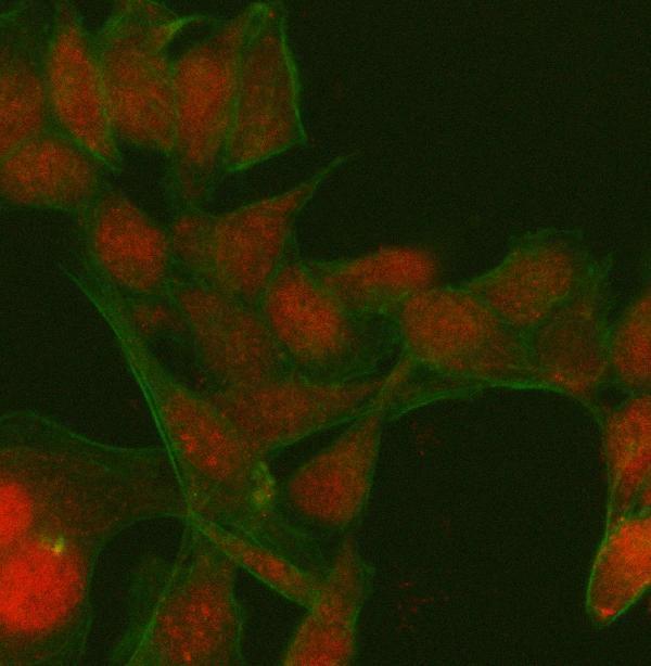  IF analysis of PATZ1 using anti-PATZ1 antibody (A06823-1) and anti-Beta Tubulin antibody (M01857-3)
