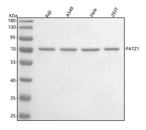  Western blot analysis of PATZ1 using anti-PATZ1 antibody (A06823-1)