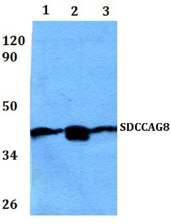 Western blot (WB) analysis of SDCCAG8 polyclonal antibody at 1:500 dilution  Lane1:HEK293T whole cell lysate
Lane2:RAW264