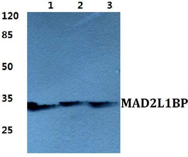 Western blot (WB) analysis of MAD2L1BP polyclonal antibody at 1:500 dilution
Lane1:HEK293T cell lysate
Lane2:Raw264