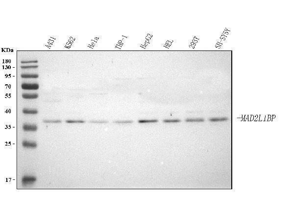  Western blot analysis of MAD2L1BP using anti-MAD2L1BP antibody (A06825-2)