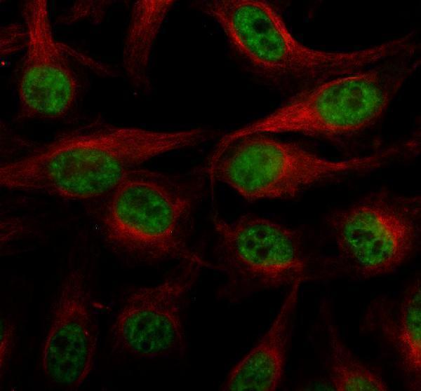 a06829 2 ddx39a b primary antibodies if testing 1
