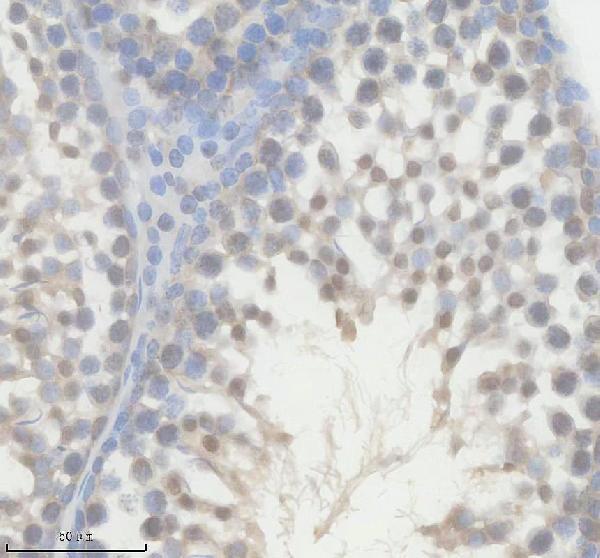 a06829 2 ddx39a b primary antibodies ihc testing 1