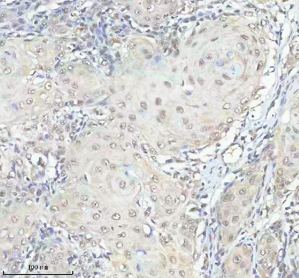 a06829 2 ddx39a b primary antibodies ihc testing 2