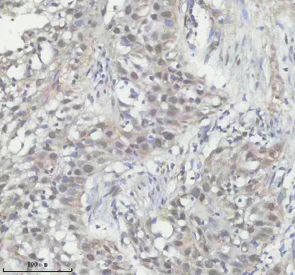 a06829 2 ddx39a b primary antibodies ihc testing 3