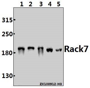 Western blot (WB) analysis of Rack7 (Q608) polyclonal antibody at 1:500 dilution
Lane1:A549 whole cell lysate(20ug)
Lane2:Panc1 whole cell lysate(10ug)
Lane3:A375 whole cell lysate(20ug)
Lane4:C6 whole cell lysate(30ug)
Lane5:BV2 whole cell lysate(40ug)