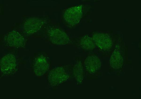 a06830 2 zmynd8 primary antibodies if testing 8