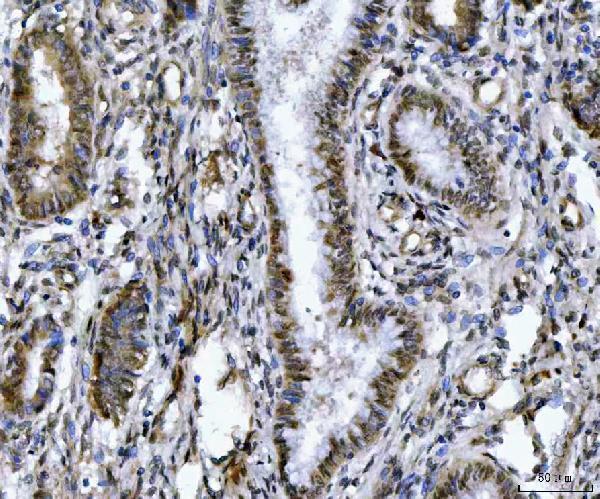  IHC analysis of ZMYND8 using anti-ZMYND8 antibody (A06830-2)