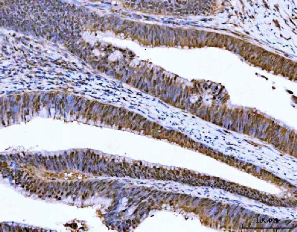  IHC analysis of ZMYND8 using anti-ZMYND8 antibody (A06830-2)
