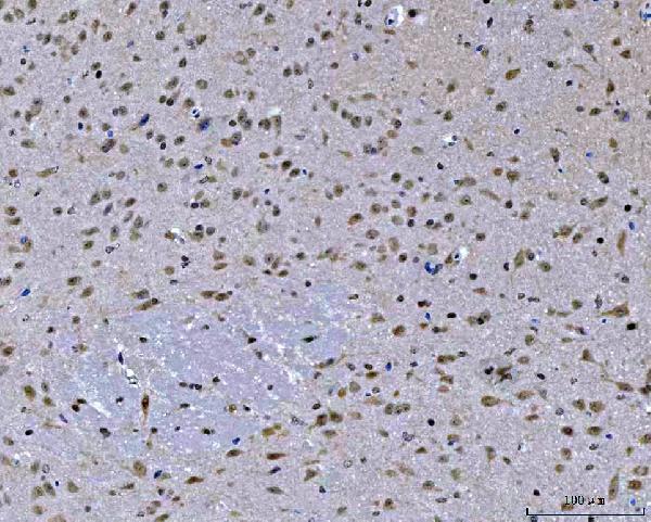 a06830 2 zmynd8 primary antibodies ihc testing 6