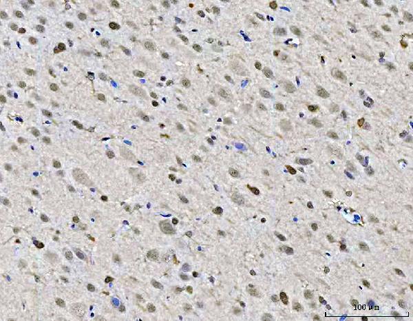 a06830 2 zmynd8 primary antibodies ihc testing 7