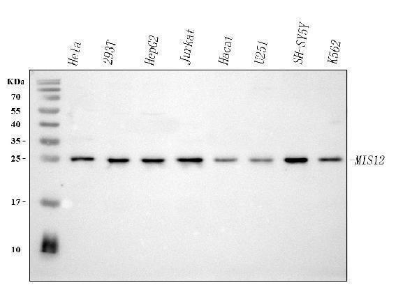  Western blot analysis of MIS12 using anti-MIS12 antibody (A06832-1)
