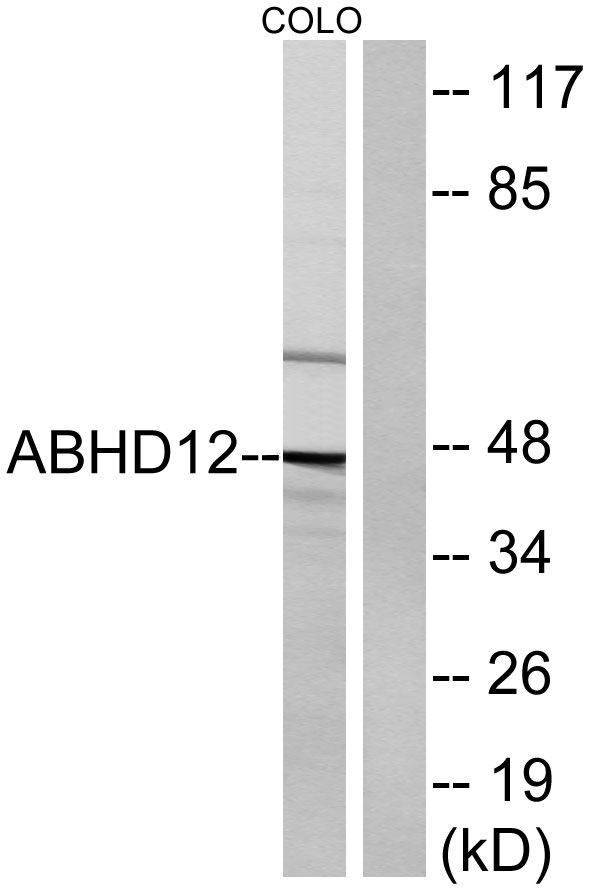 Western blot analysis of lysates from COLO cells, using ABHD12 Antibody
