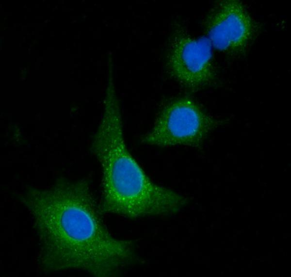 a06836 1 vps53 primary antibodies if testing 6