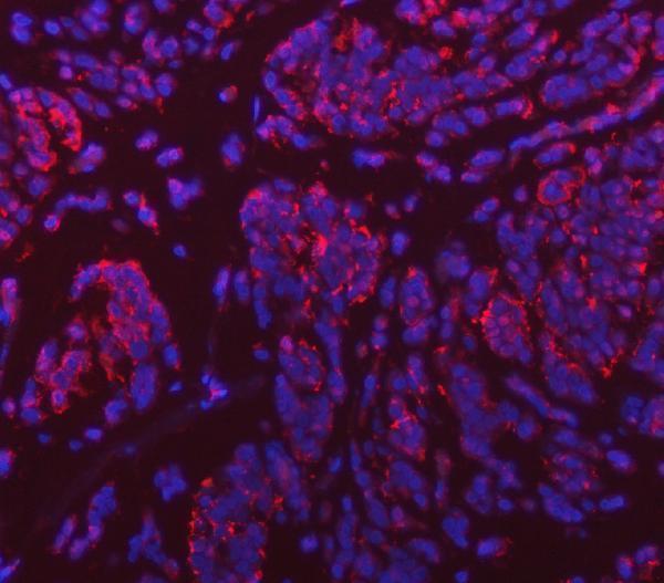 a06836 1 vps53 primary antibodies if testing 8