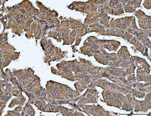  IHC analysis of VPS53 using anti-VPS53 antibody (A06836-1)