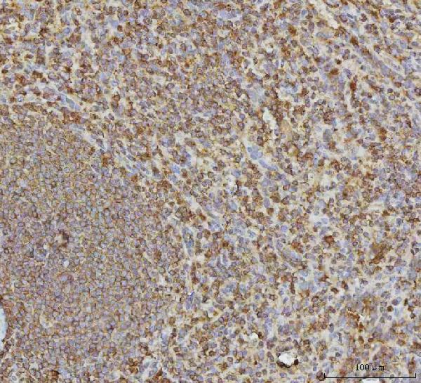  IHC analysis of VPS53 using anti-VPS53 antibody (A06836-1)