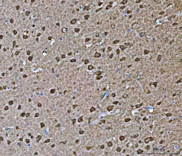 a06836 1 vps53 primary antibodies ihc testing 5