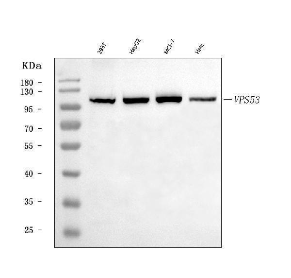  Western blot analysis of VPS53 using anti-VPS53 antibody (A06836-1)