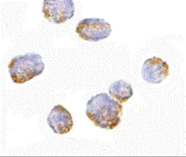 Immunocytochemistry of VPS53 in 293 cells with VPS53 antibody at 5 μg/mL
