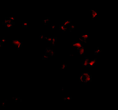 Immunofluorescence of VPS53 in 293 cells with VPS53 antibody at 2