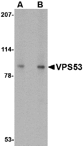 Western blot analysis of VPS53 in 293 cell lysate with VPS53 antibody at (A) 0