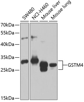 Western blot analysis of extracts of various cell lines, using GSTM4 antibody  at 1:1000 dilution