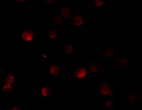 a06838 pappa2 primary antibodies if testing 3
