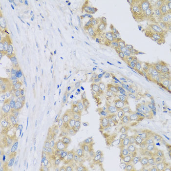 Immunohistochemistry of paraffin-embedded mouse stomach using ARFGAP3 antibody at dilution of 1:100 (x40 lens)