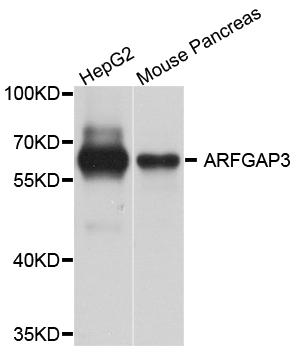 Western blot analysis of extract of various cells, using ARFGAP3 antibody