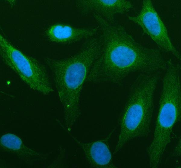 a06840 gpc6 primary antibodies if testing 1