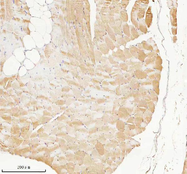  IHC analysis of PHPT1 using anti-PHPT1 antibody (A06841)